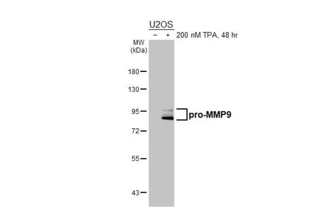 100UL MMP9 RMAB 100 UL
