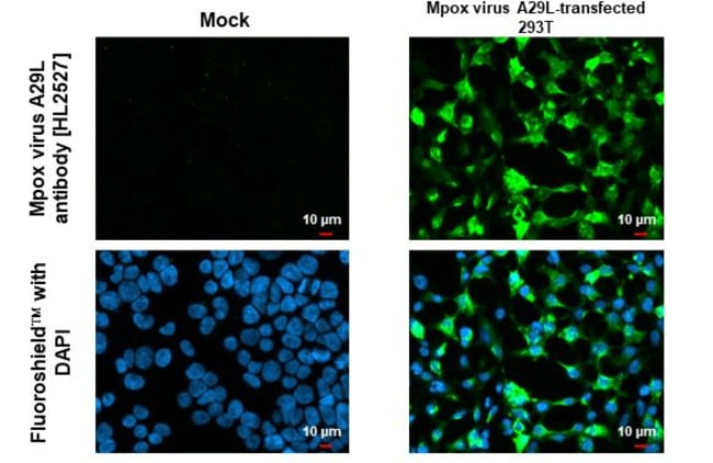 100UL MONKEYPOX VIRUS A29L (MPX RMAB 100
