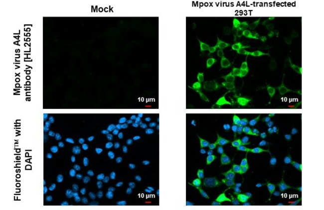 100UL MONKEYPOX VIRUS A4L (MPXV RMAB 100