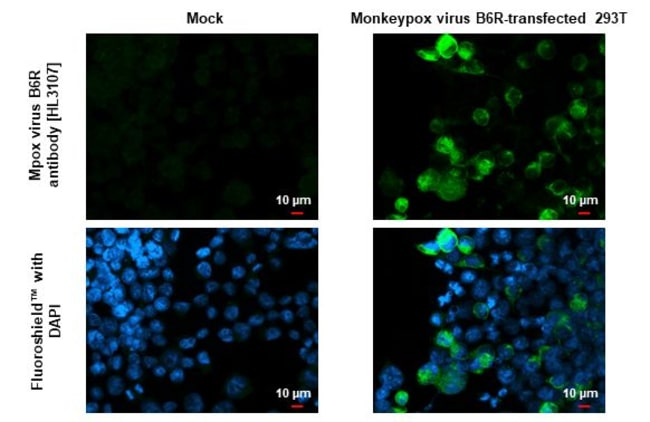 100UL MONKEYPOX VIRUS B6R (STRA RMAB 100