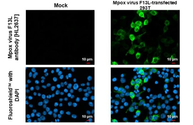 100UL MONKEYPOX VIRUS F13L (MPX RMAB 100