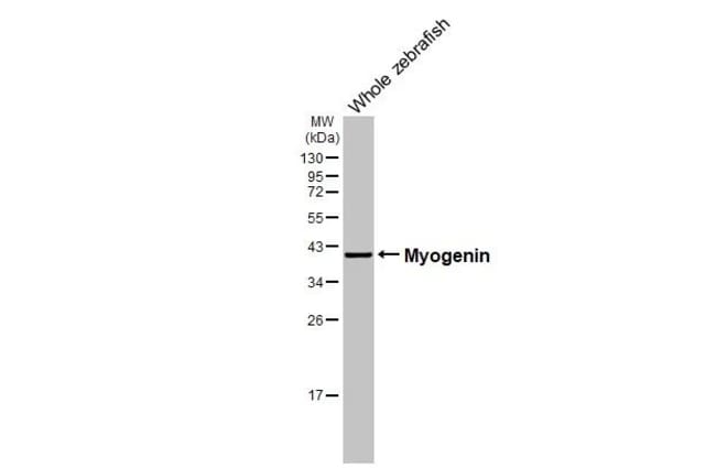 100UL MYOGENIN RMAB 100 UL