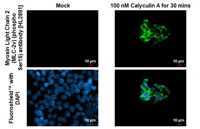 100UL PHOSPHO-MYL2 (SER15) RMAB 100 UL