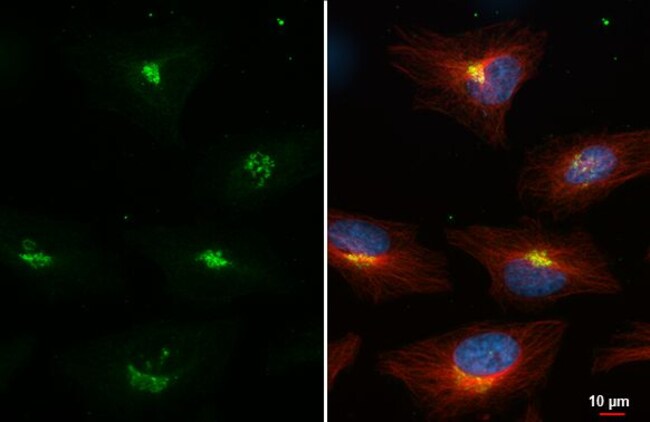 100UL NUCLEOBINDIN 1 RMAB 100 UL