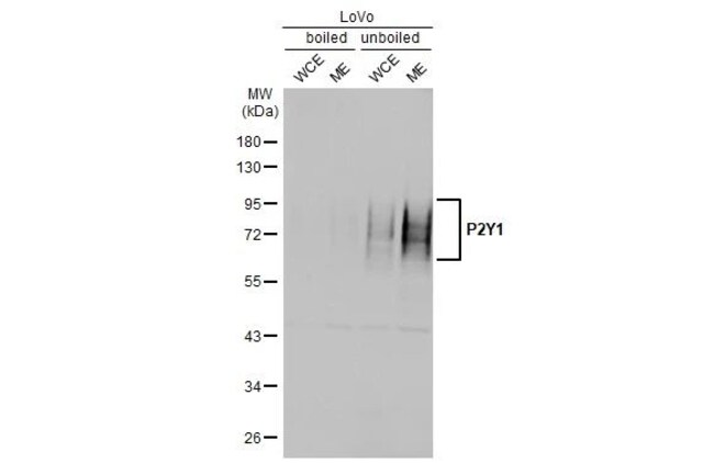 100UL P2Y1 RMAB 100 UL
