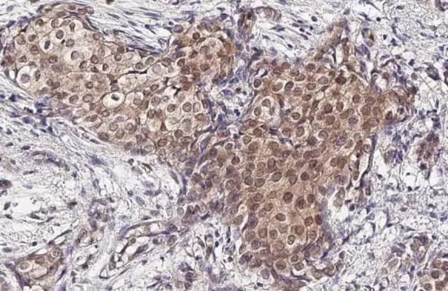 100UL PHOSPHO-P38 MAPK (TYR182) RMAB 100