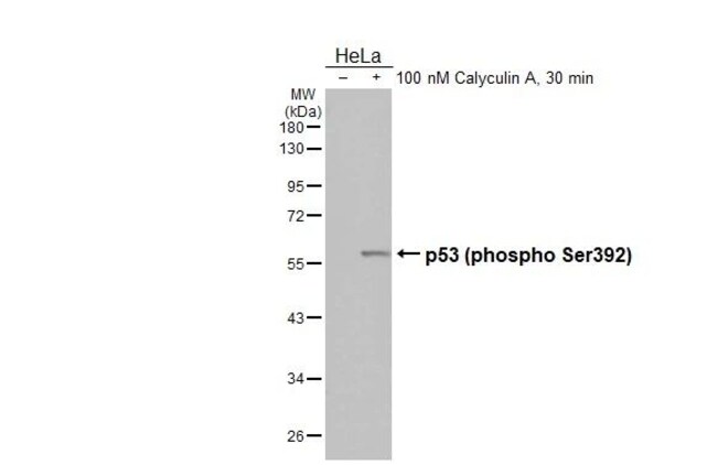 100UL PHOSPHO-P53 (SER392) RMAB 100 UL
