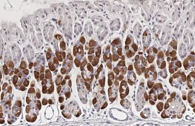 100UL PCSK9 RMAB 100 UL