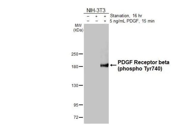 100UL PHOSPHO-PDGF RECEPTOR BET RMAB 100