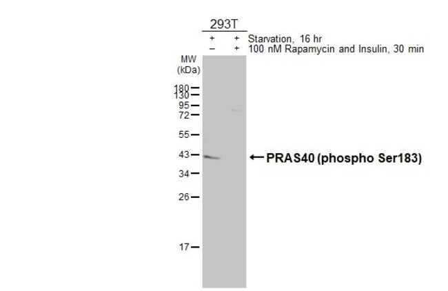 100UL PHOSPHO-PRAS40 (SER183) RMAB 100 U
