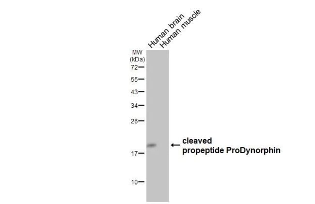 100UL PRODYNORPHIN RMAB 100 UL