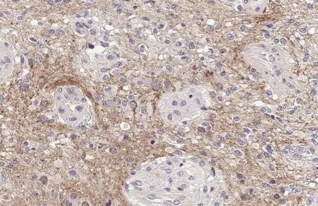 100UL PRODYNORPHIN RMAB 100 UL