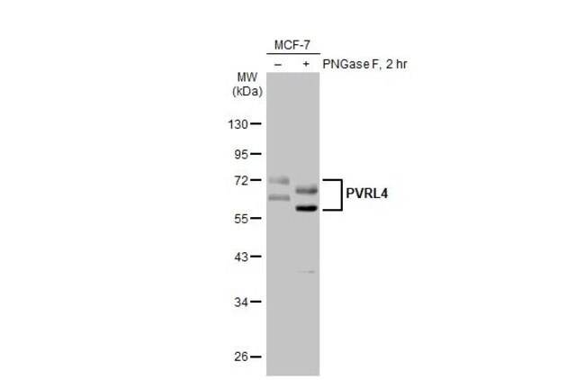 100UL NECTIN 4 RMAB 100 UL