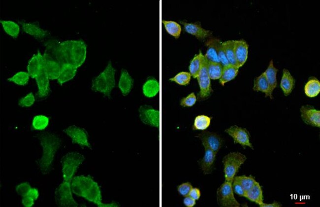 100UL K-RAS (G12D MUTANT) RMAB 100 UL
