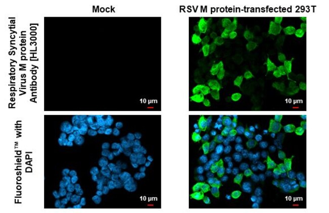 100UL RSV M PROTEIN RMAB 100 UL
