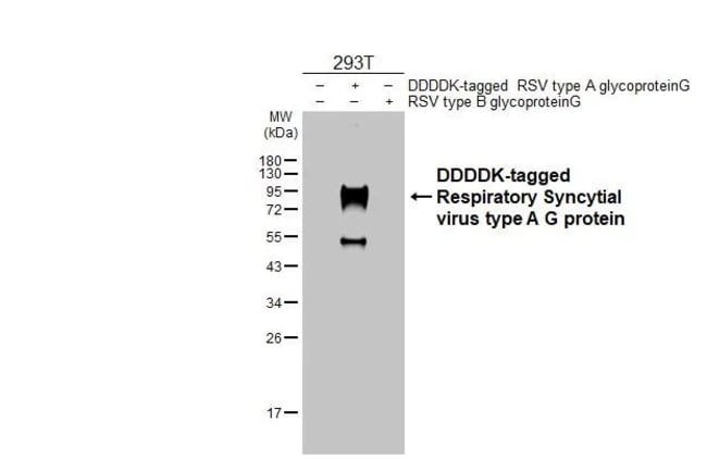 100UL RSV TYPE A GLYCOPROTEIN G RMAB 100