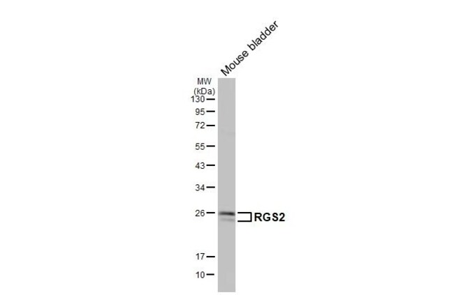 100UL RGS2 RMAB 100 UL