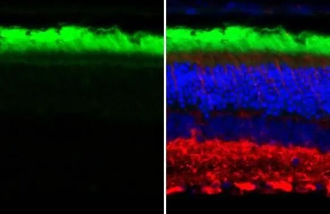 100UL RHODOPSIN RMAB 100 UL