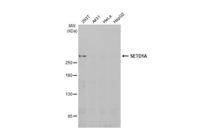 100UL SETD1A RMAB 100 UL