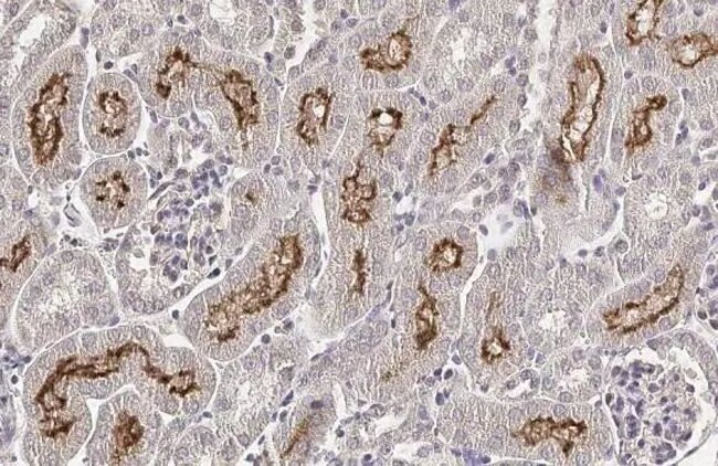 100UL SLC5A8 RMAB 100 UL