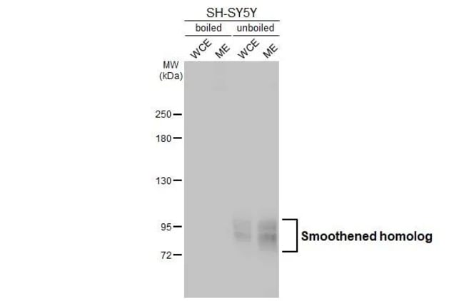 100UL SMO RMAB 100 UL