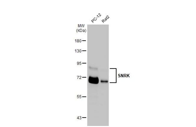 100UL SNRK RMAB 100 UL