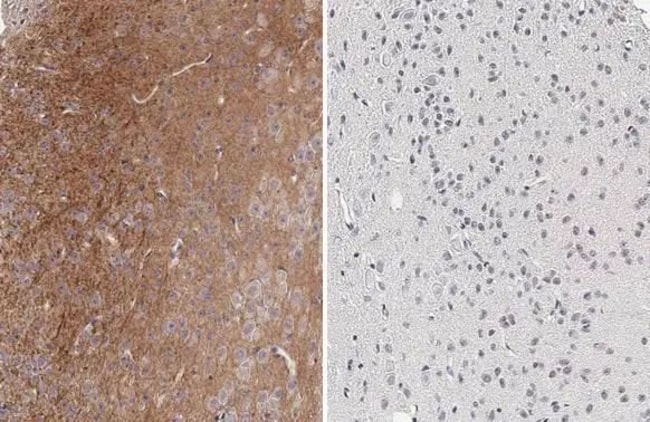 100UL PHOSPHO-TAU (THR181) RMAB 100 UL