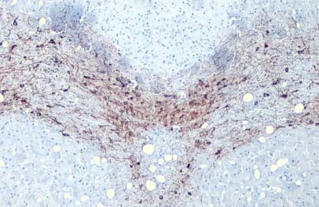 100UL TYROSINE HYDROXYLASE RMAB 100 UL