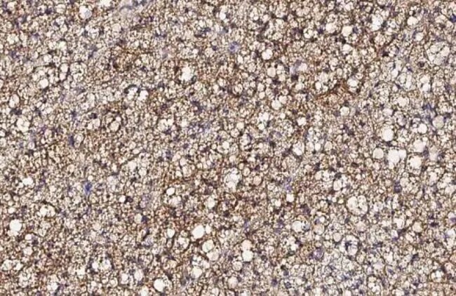 100UL UCP1 RMAB 100 UL