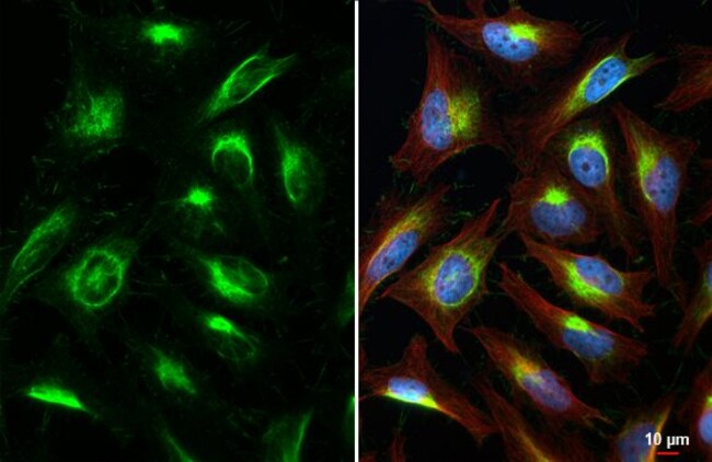 100UL VIMENTIN RMAB 100 UL