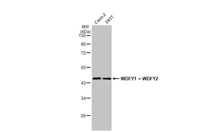 100UL WDFY1/2 RMAB 100 UL