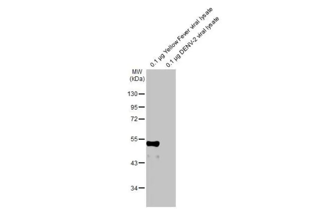 100UL YELLOW FEVER VIRUS ENVELO RMAB 100