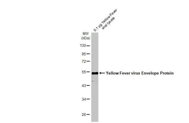 100UL YELLOW FEVER VIRUS ENVELO RMAB 100