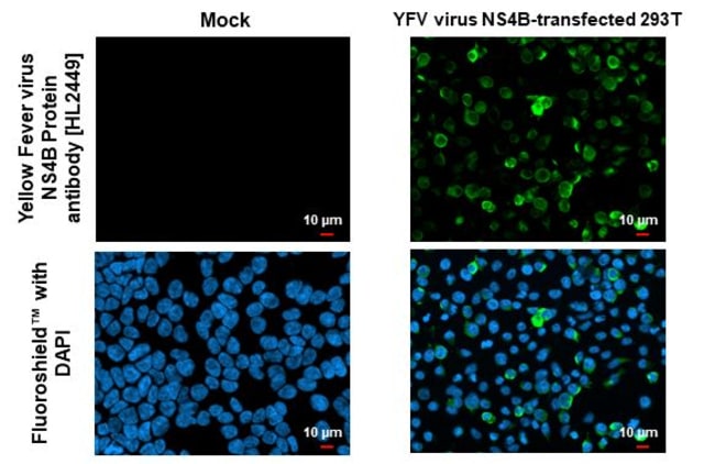 100UL YELLOW FEVER VIRUS NS4B ( RMAB 100