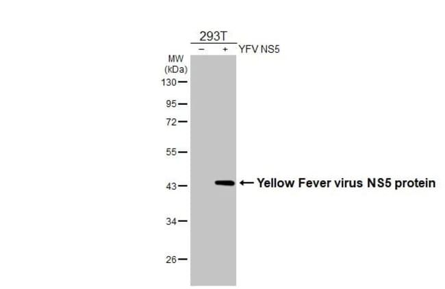 100UL YELLOW FEVER VIRUS NS5 (S RMAB 100