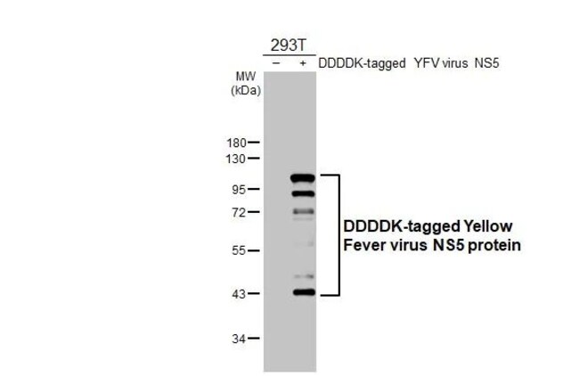100UL YELLOW FEVER VIRUS NS5 RMAB 100 UL