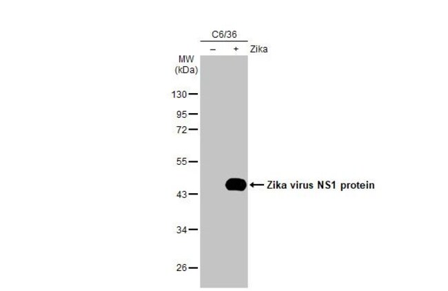 100UL ZIKA VIRUS NS1 (STRAIN H/ RMAB 100
