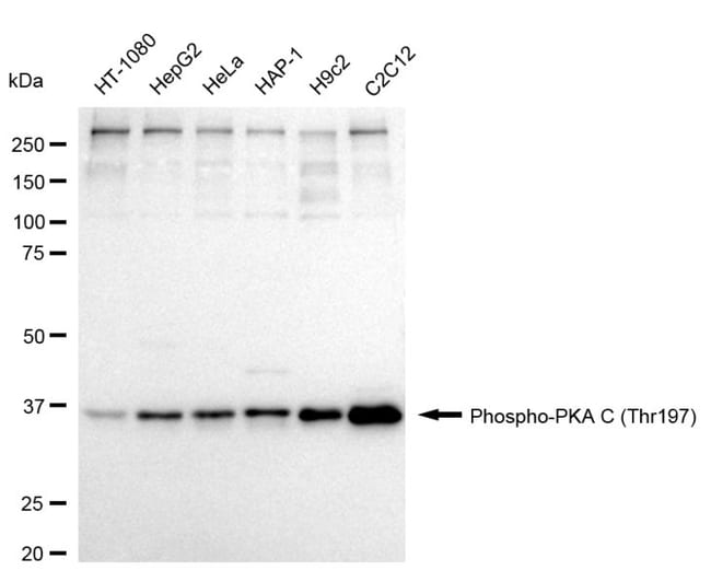 100UL PHOSPHO-PKA ALPHA/BETA/GA RMAB 100