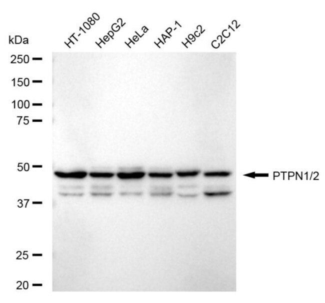 100UL PTP1B/PTPN2 RMAB 100 UL
