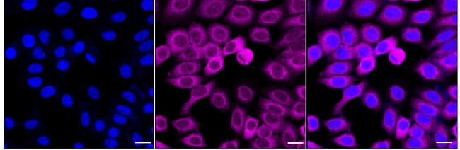 100UL TCP1 RMAB 100 UL
