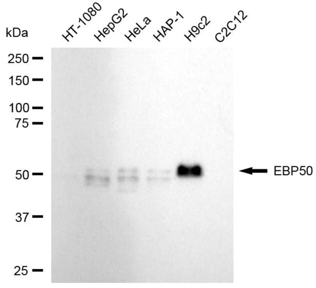 100UL EBP50 RMAB 100 UL
