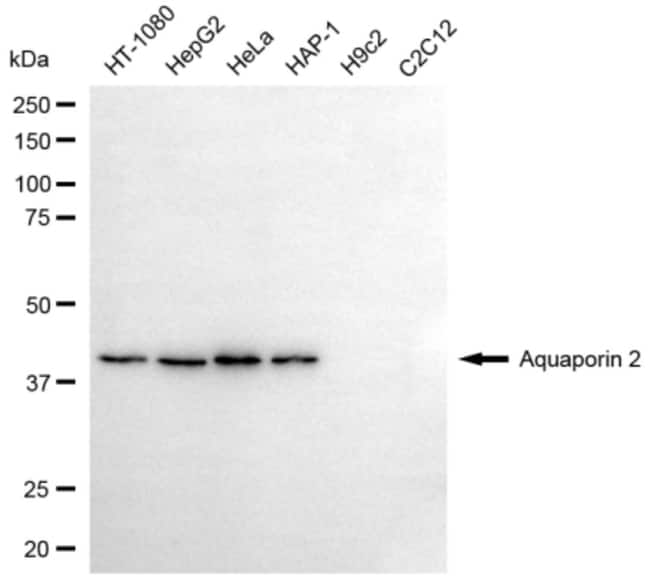 100UL AQUAPORIN 2 RMAB 100 UL
