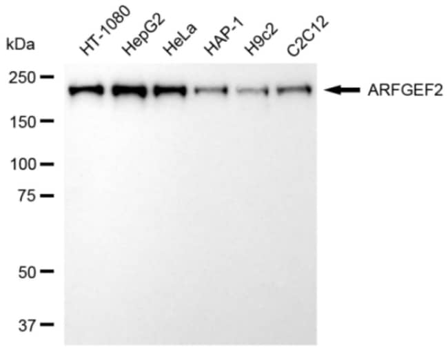 100UL ARFGEF2 RMAB 100 UL