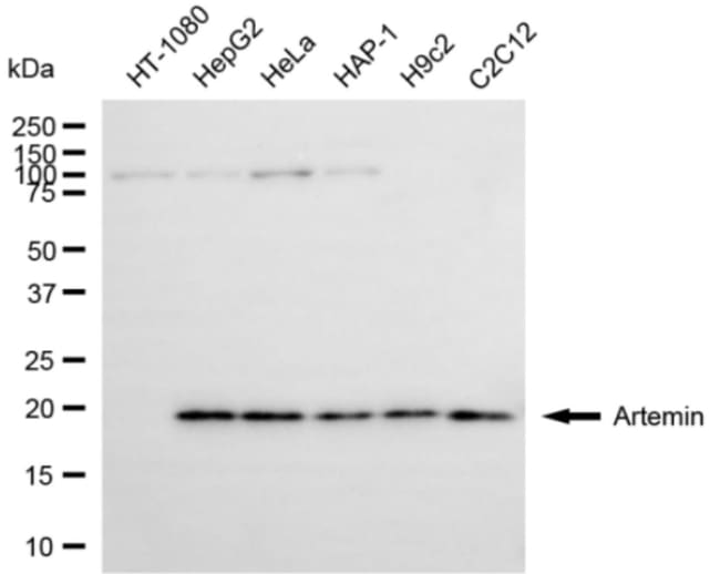 100UL ARTEMIN RMAB 100 UL