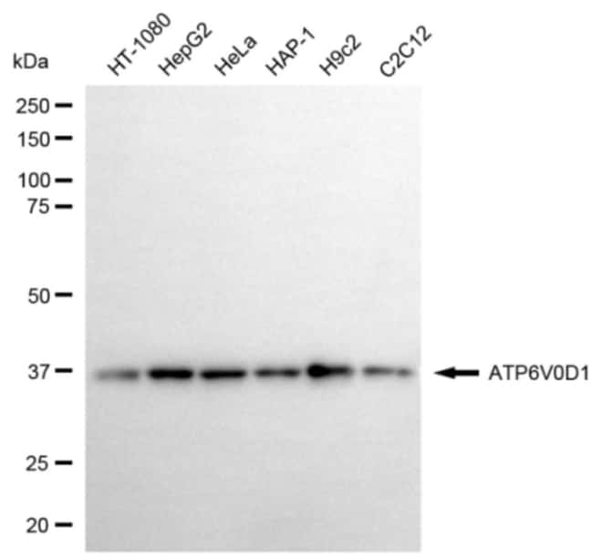 100UL ATP6V0D1 RMAB 100 UL