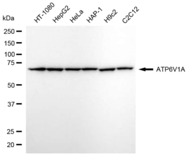 100UL ATP6V1A RMAB 100 UL