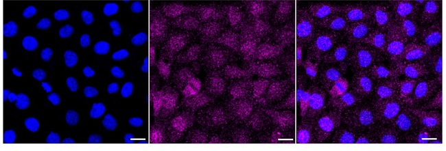 100UL DPYSL3 RMAB 100 UL