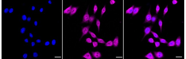 100UL ENDOTHELIN B RECEPTOR RMAB 100 UL