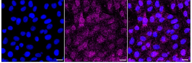 100UL FOLLISTATIN RMAB 100 UL