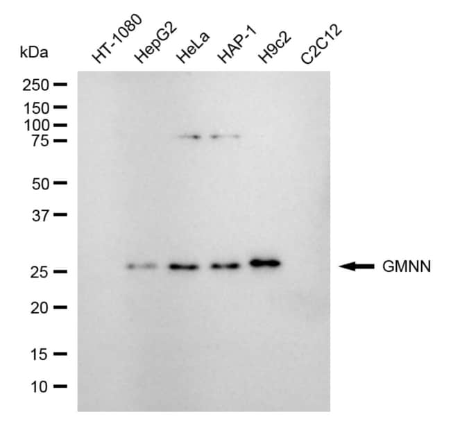 100UL GMNN RMAB 100 UL